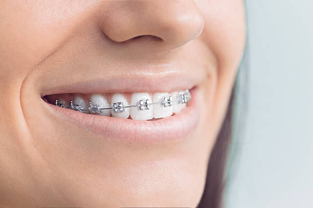 Best Traditional Braces  in Ferriday, LA